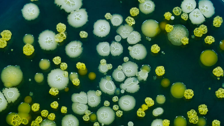 Various bacteria on a slide