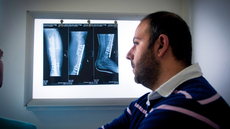 Patient by X-rays