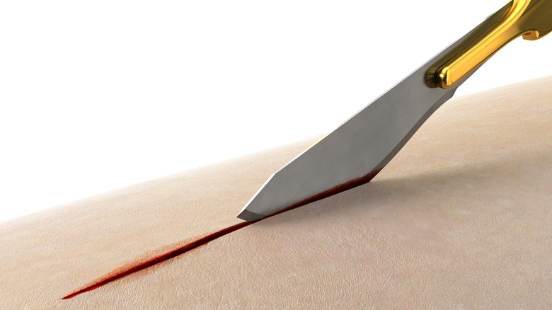 Scalpel slicing through skin