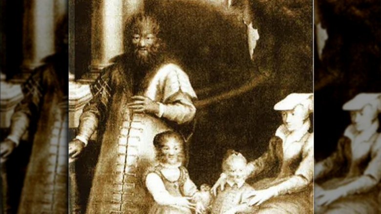 The Gonsalvus family