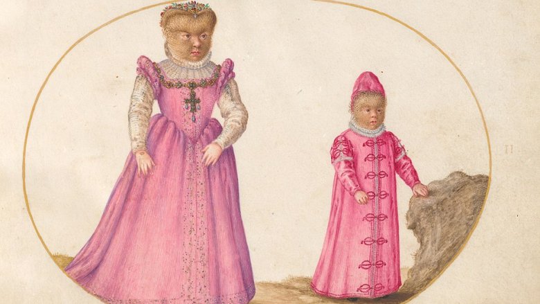 Gonsalvus children