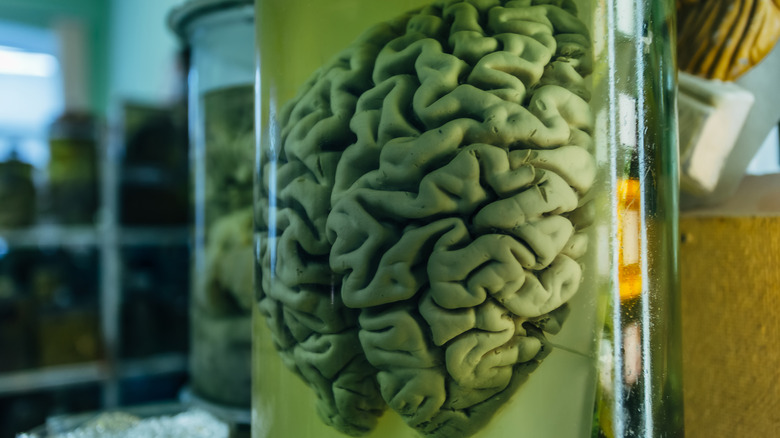 brain in a jar