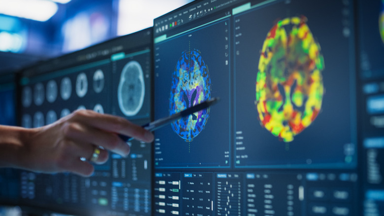 Hand pointing at a computer screen with brain scans on them