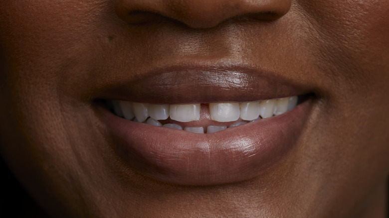 Close-up of smiling mouth