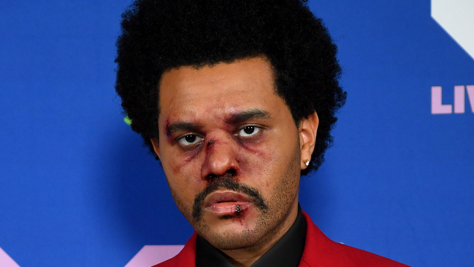 Did The Weeknd Get Plastic Surgery The Photo Explained | Images and ...
