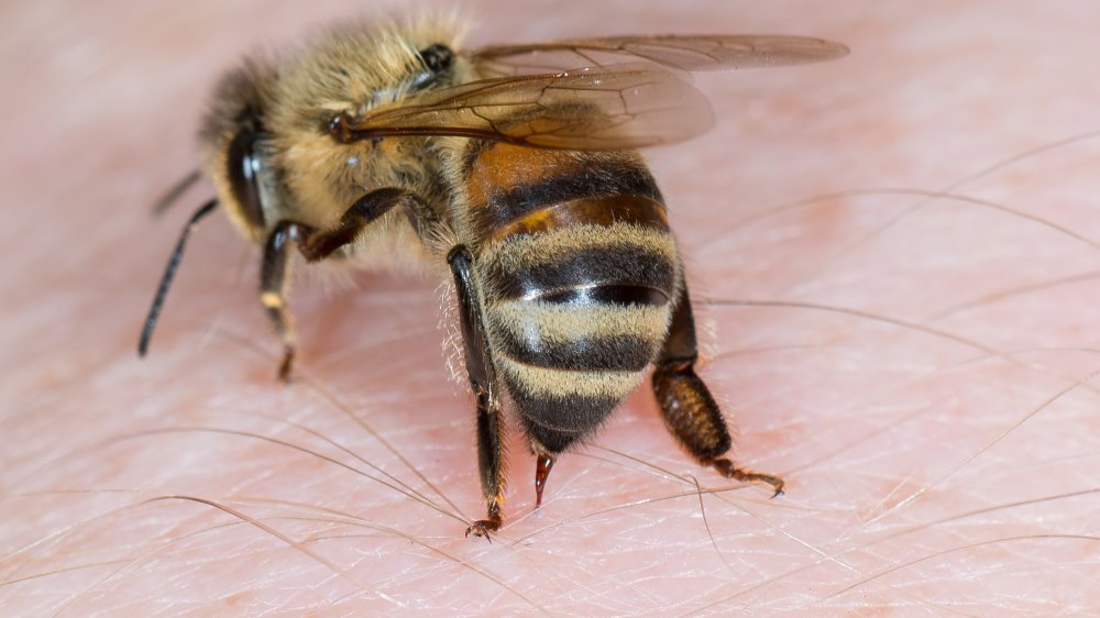 Bee sting