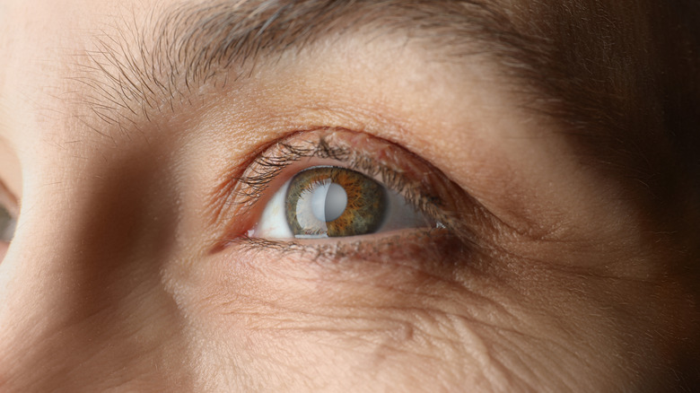 Human eyeball