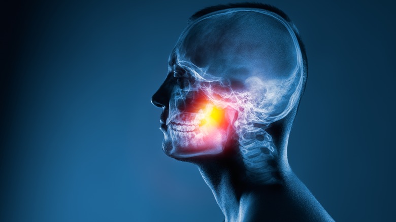 X ray of man in profile