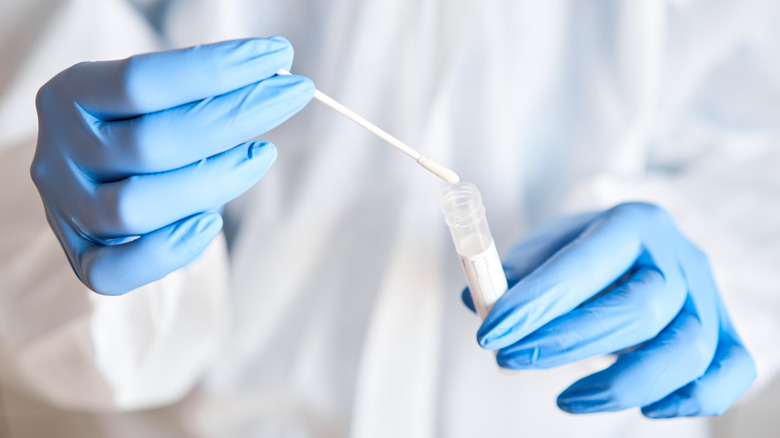 DNA testing