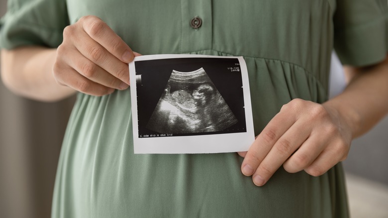 Woman holding ultrasound photo