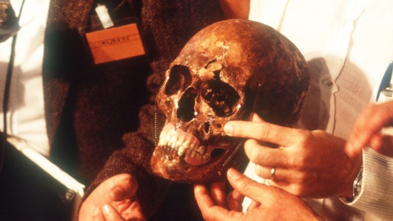 the skull of Josef Mengele