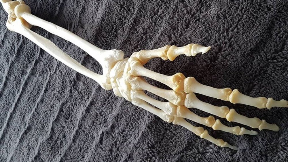 Preserved arm bones