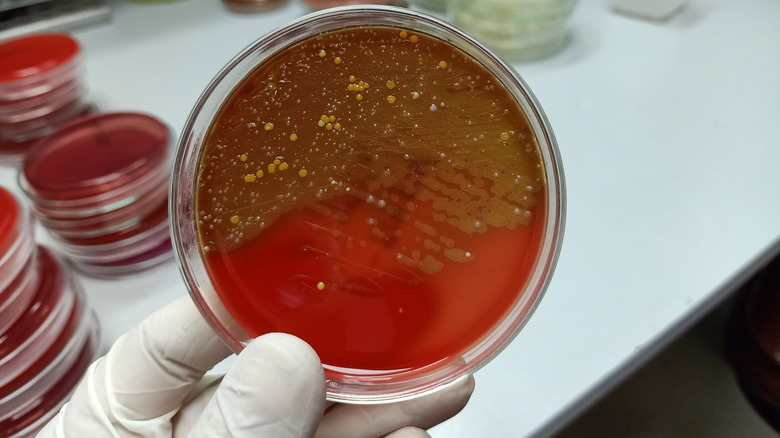 Scientist holding a petri dish with bacteria