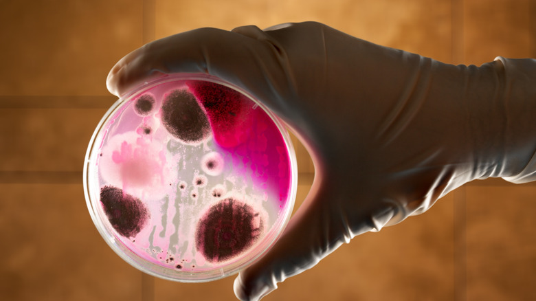 Anthrax bacteria petri dish