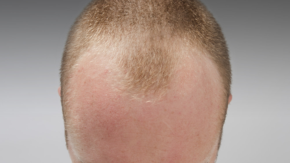 A man with a widow's peak