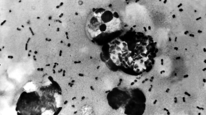 the yersinia pestis bacterium