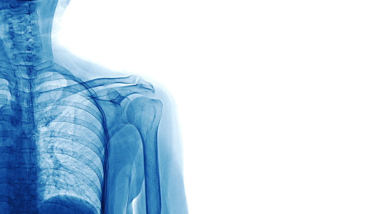 x-ray shoulder skeleton