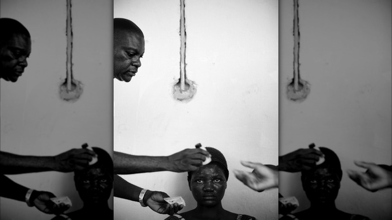 Congolese patients