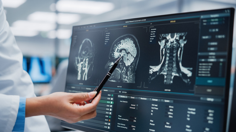 Medical professional examining brain scan