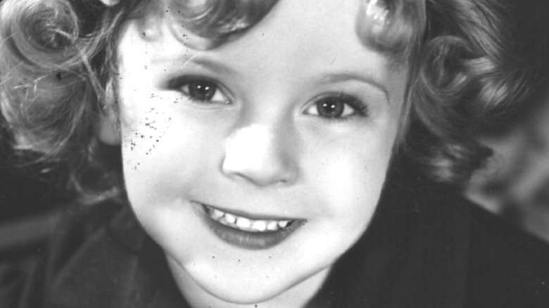 Shirley Temple smile curls
