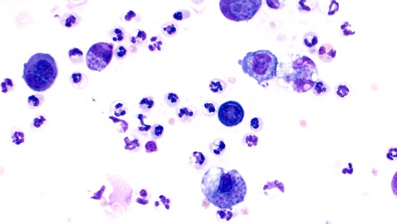 Toxoplasma gondii microscope