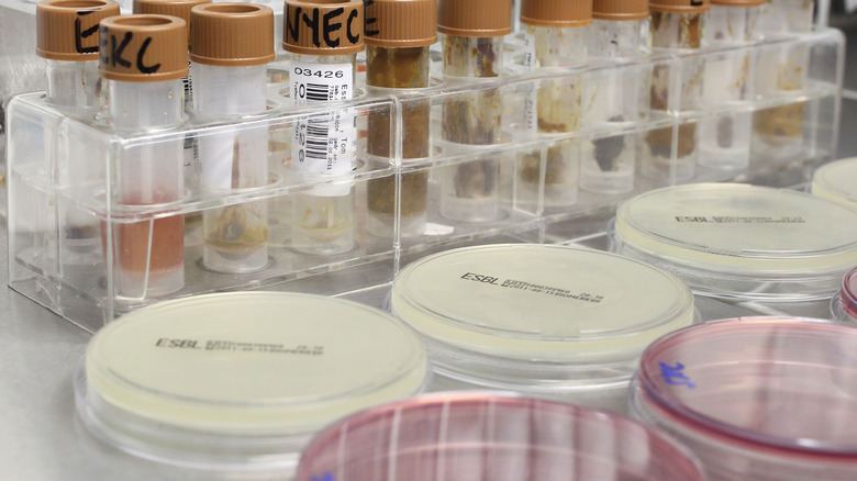 Ecoli petri dishes