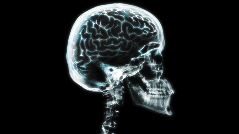 Human skull and brain