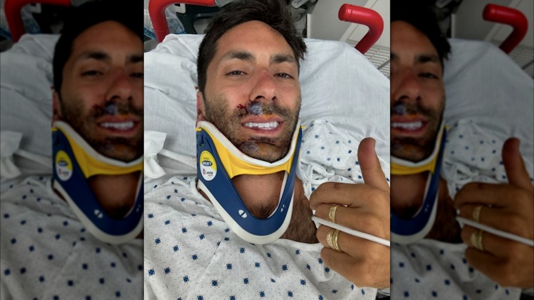 Nev Schulman after breaking his neck