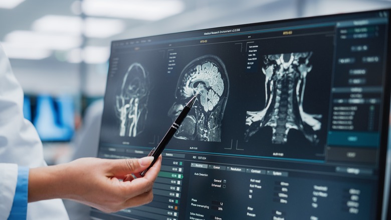 Brain scan for signs of trauma