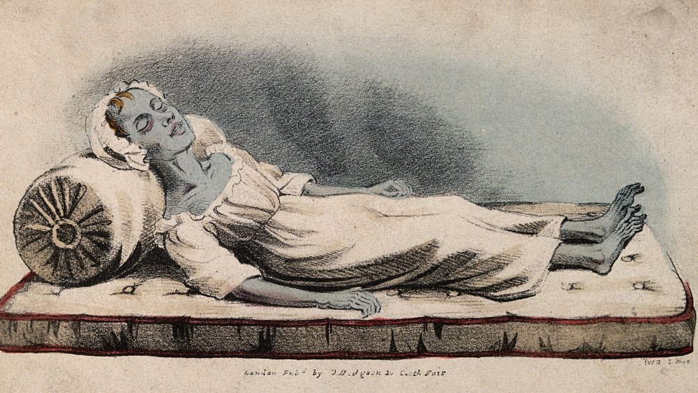 A dead victim of cholera at Sunderland in 1832. Coloured lithograph by IWG