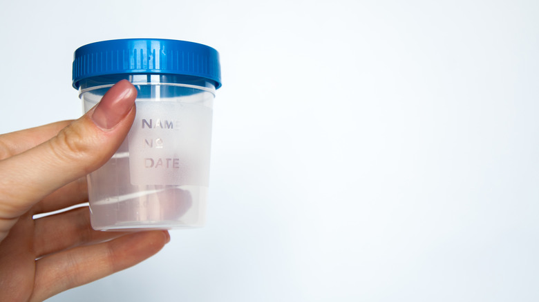 cup for urine collection