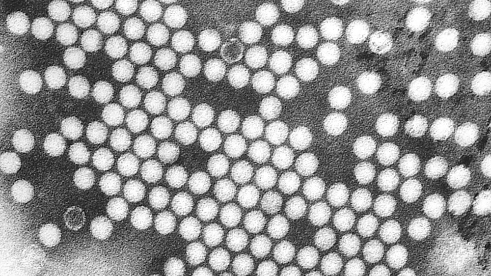 Electron micrograph of the poliovirus. 1975.