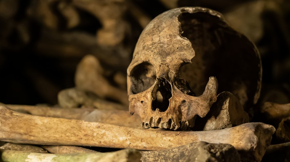 broken skull