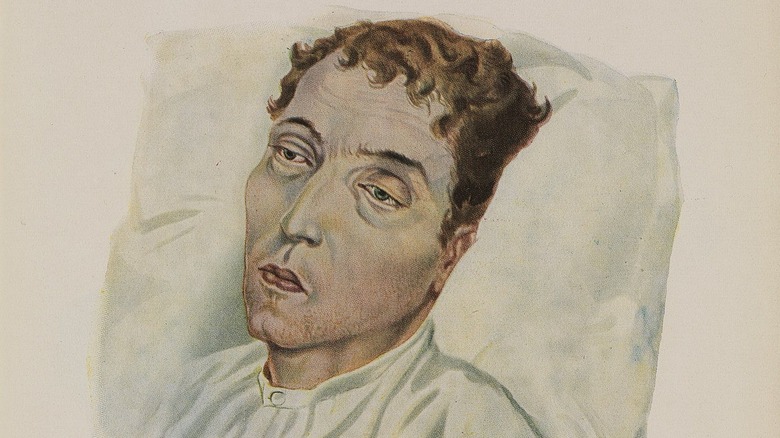Man suffering from dysentery