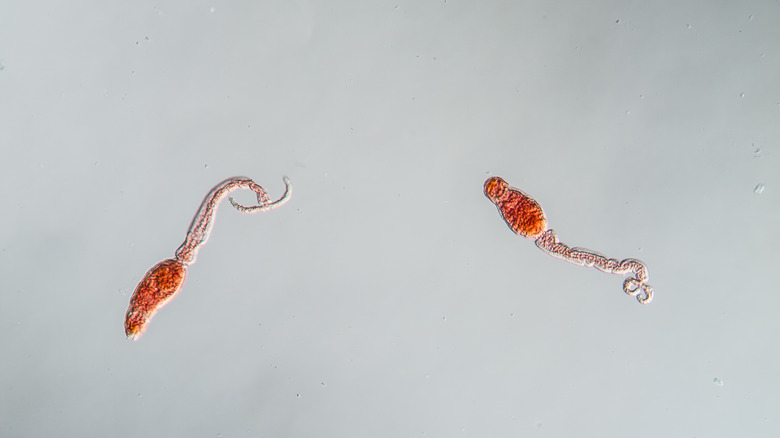Schistosomiasis worms squirm under high resolution.