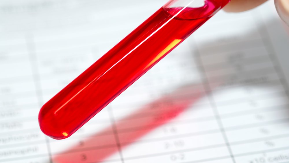 Blood sample