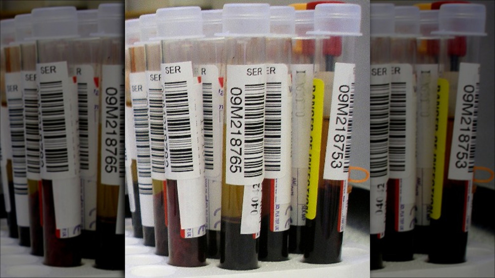 Blood in test tubes for a study