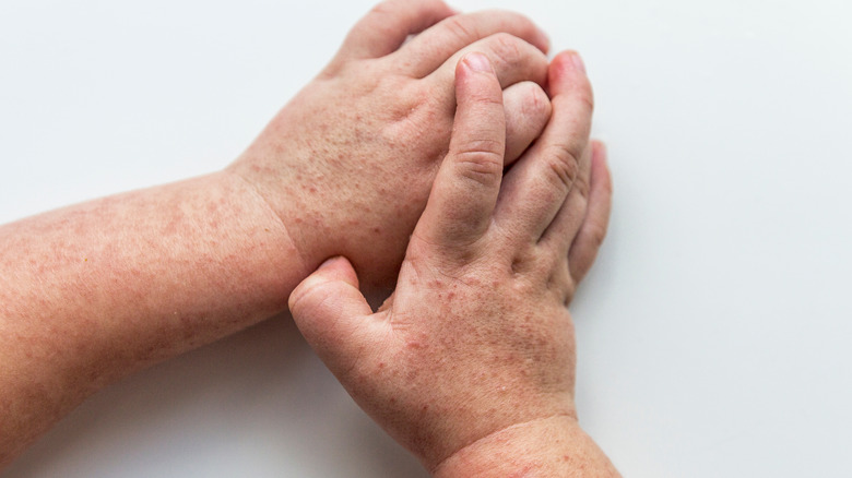 feverish hands clasped together