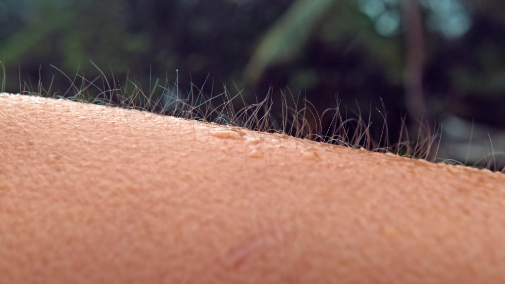 Goosebumps