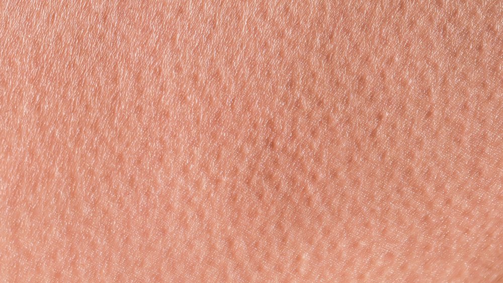 Goosebumps