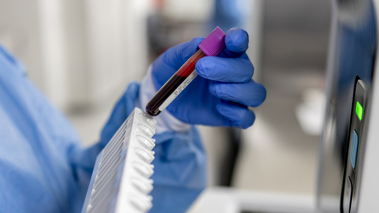 technician blood filled vial tray