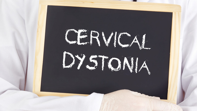 cervical dystonia