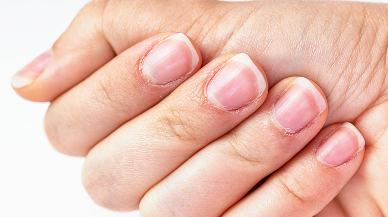 Top 10 Beauty Tips To Grow Long And Stronger Nails Naturally