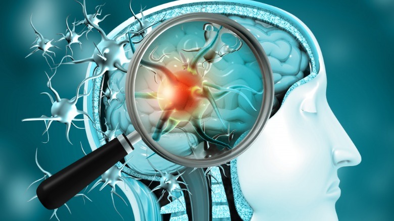 magnifying glass over brain infection