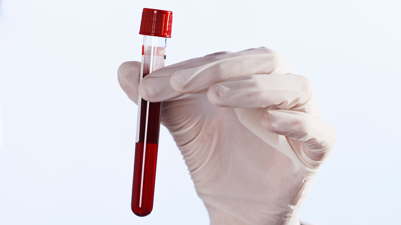 person holding blood vial