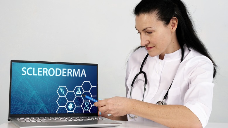 doctor gesturing to presentation about scleroderma