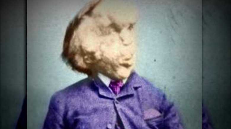 Joseph Merrick "the Elephant Man"