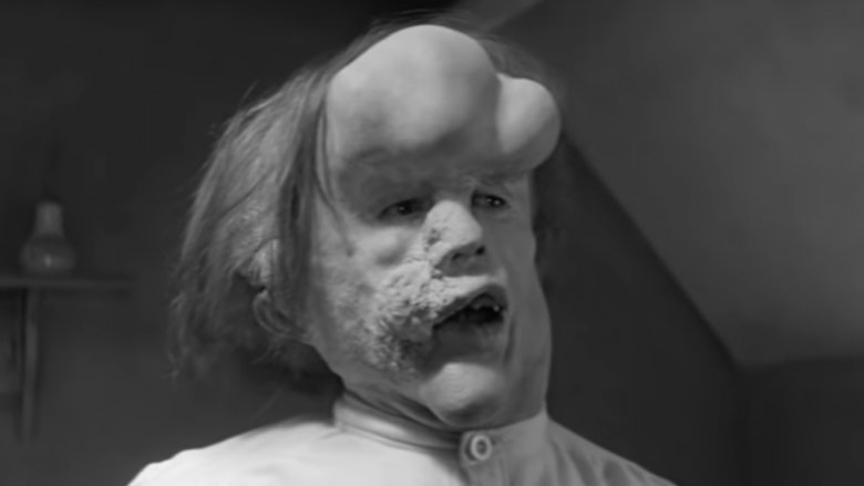 John Hurt as Joseph Merrick "the Elephant Man"