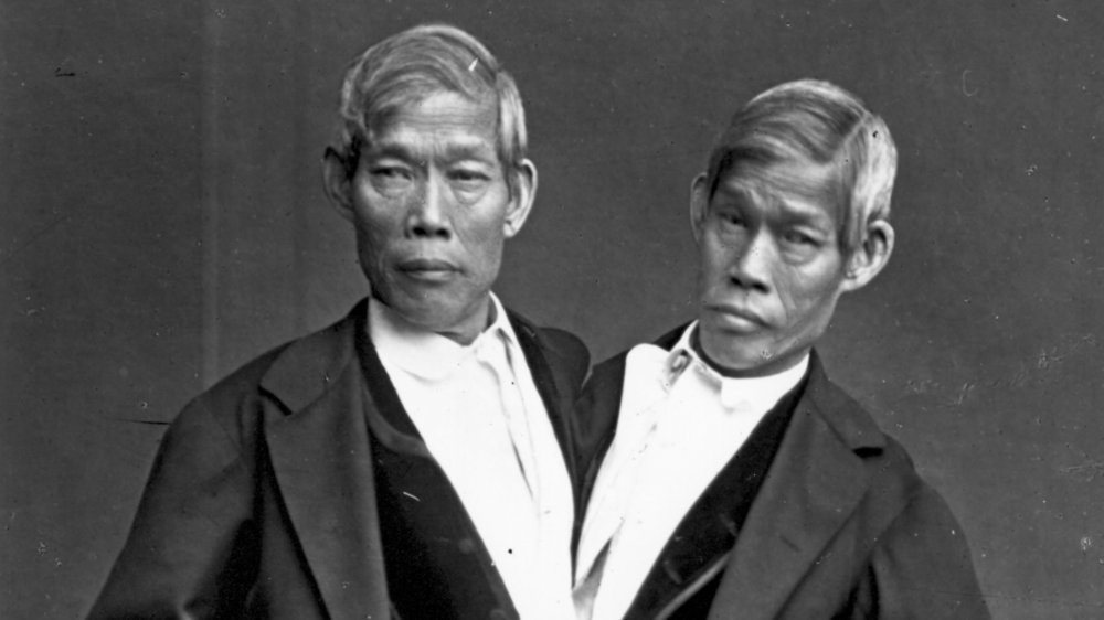 1865: The most famous Siamese twins, Chang and Eng Bunker