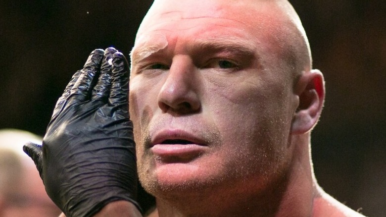 Lesnar with cut man